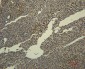 Transferrin Monoclonal Antibody(4B4)
